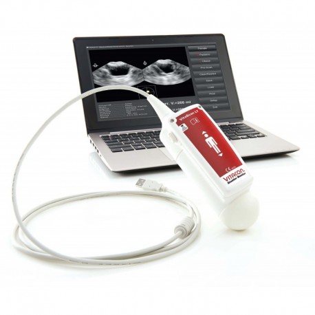 Bladder scanner VITASCAN